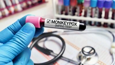 Germany’s Disease Control Centre Reports 1st Case of New Mpox Variant