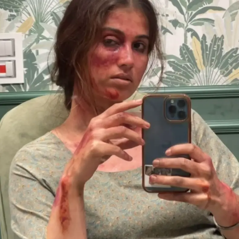 Description of the pic