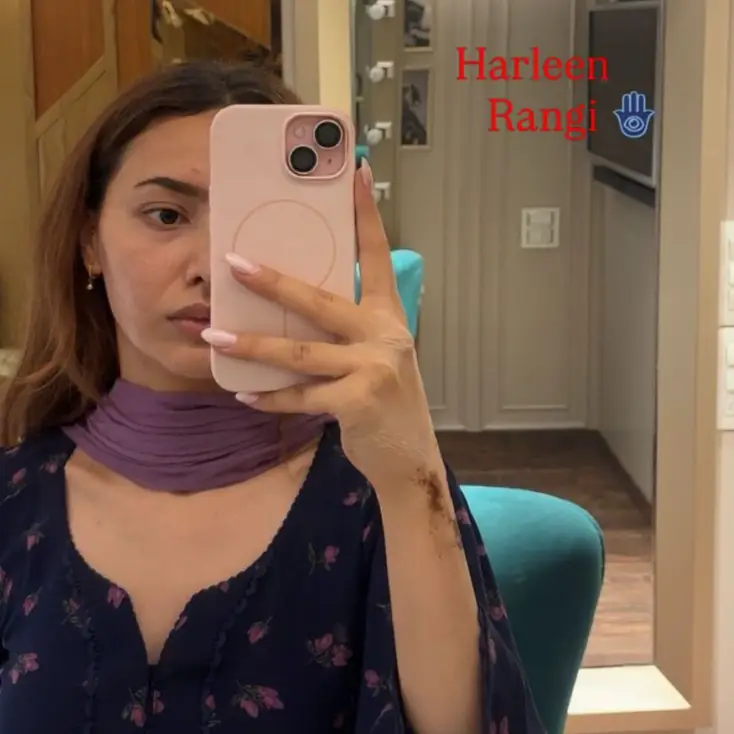 Description of the pic