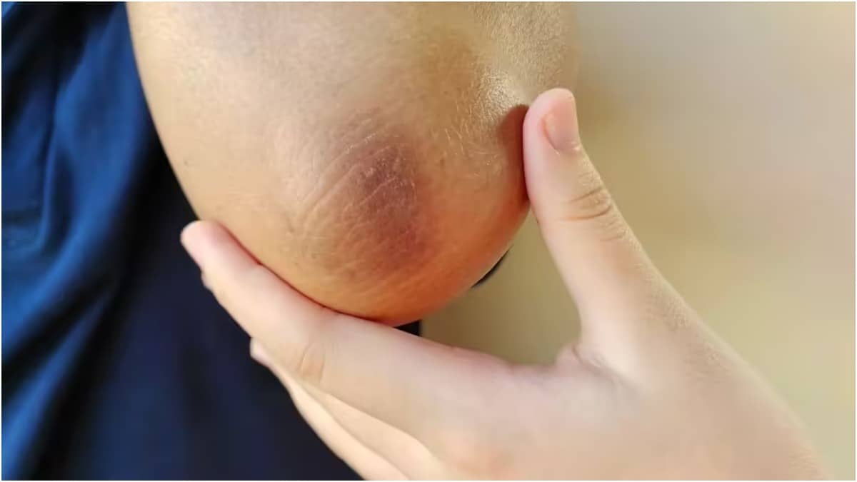 A mixture of vaseline and turmeric can heal dark and rough elbows