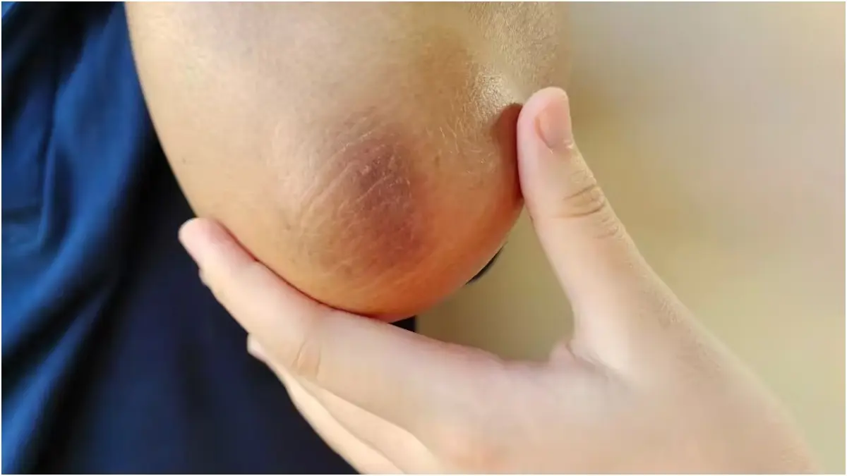 Have Dark Elbows? Here's How To Get Back The Natural Colour Of Your Skin A mixture of vaseline and turmeric can heal dark and rough elbows