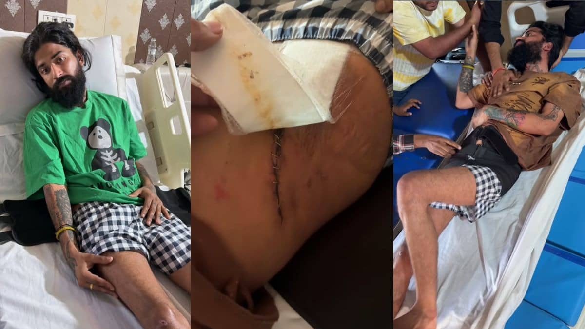 'नीचे वाला एरिया डैमेज हो गया है...' भयानक एक्सीडेंट के बाद अनुराग डोभाल का दाहिना पैर सुन्न, कभी न चल पाने की कही बात