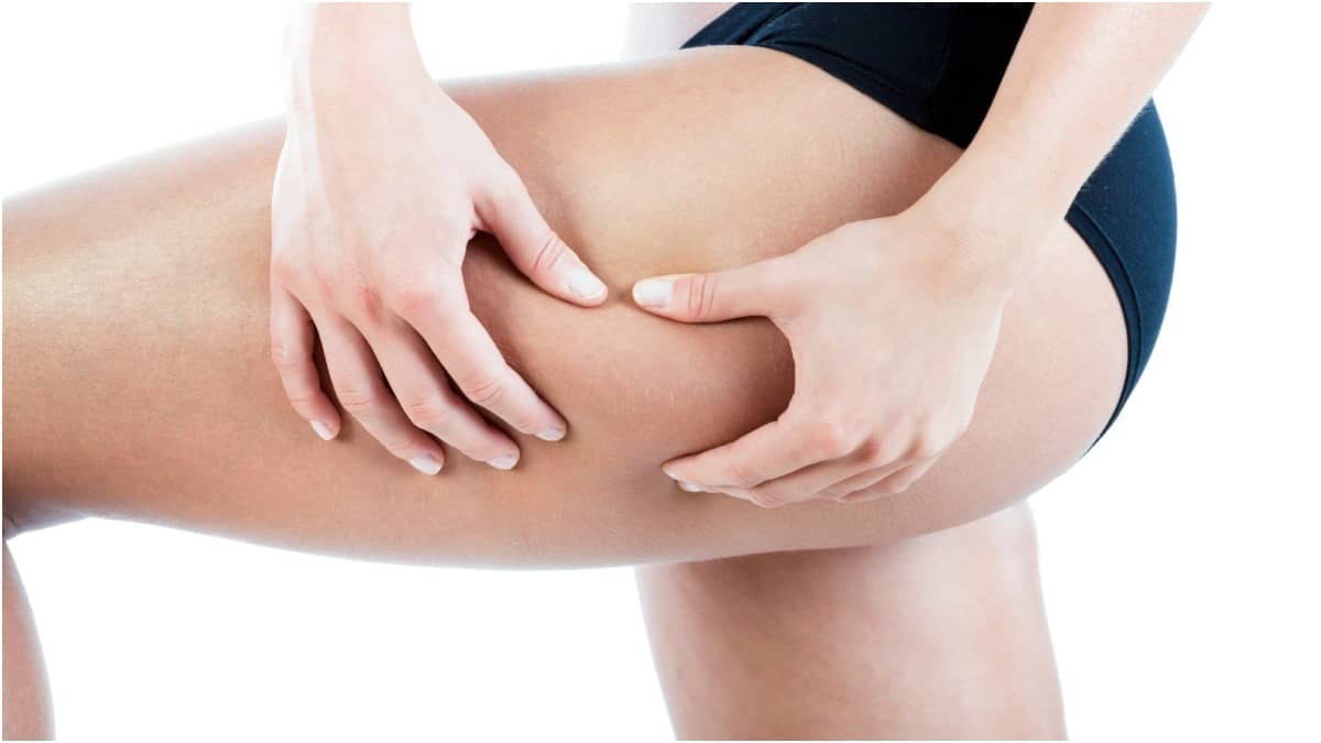 Fat in the thigh area is difficult to lose, but strict diet and workout will certainly help