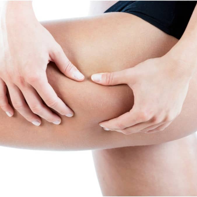 Fat in the thigh area is difficult to lose, but strict diet and workout will certainly help