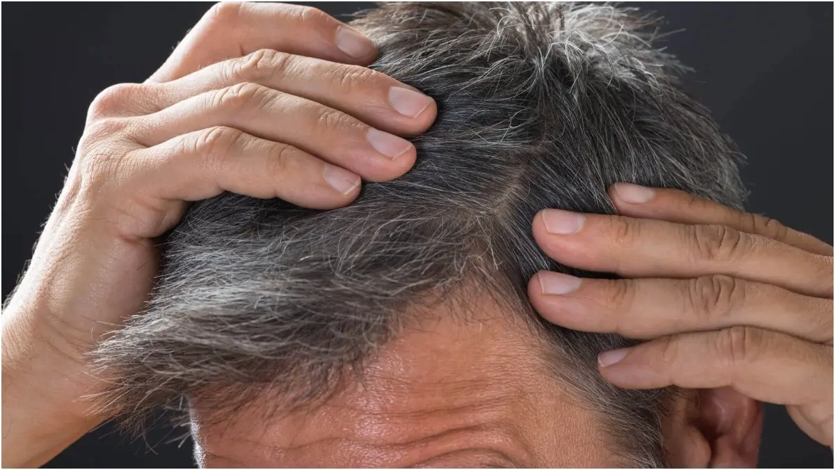 Premature Greying Of Hair: Causes And Natural Ways To Take Care Of Your Locks Genetics and stress can cause premature greying of hair