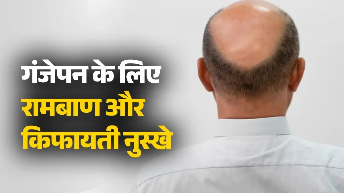 Hair Growth: तेजी से झड़ रहे बाल और बन रहे पैच? गंजेपन दूर करने के लिए अपनाएं ये घरेलू रामबाण उपाय, लहराने लगेंगी जुल्फें Hair Growth
