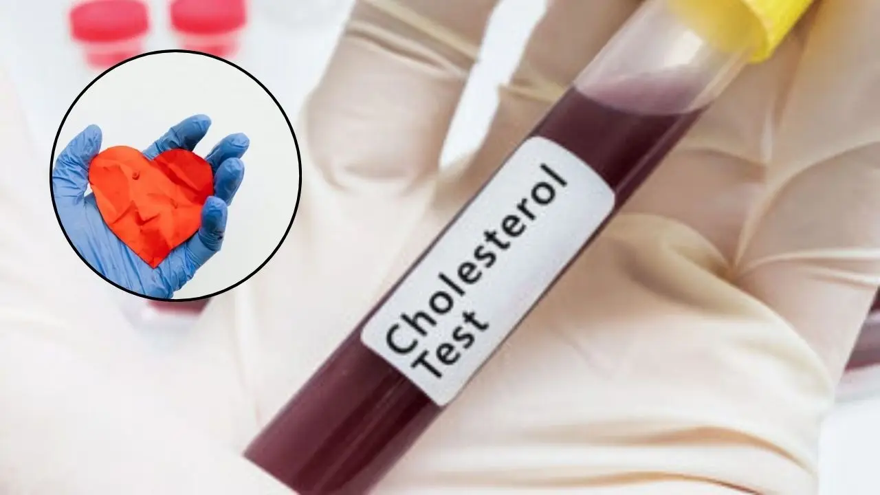 Cholesterol Check Must Before You Kid Turns A Teen To Prevent Heart Attacks In Future, See Guidelines Heart Health: Here's Why To Get Your Teen Kids Tested For Cholesterol