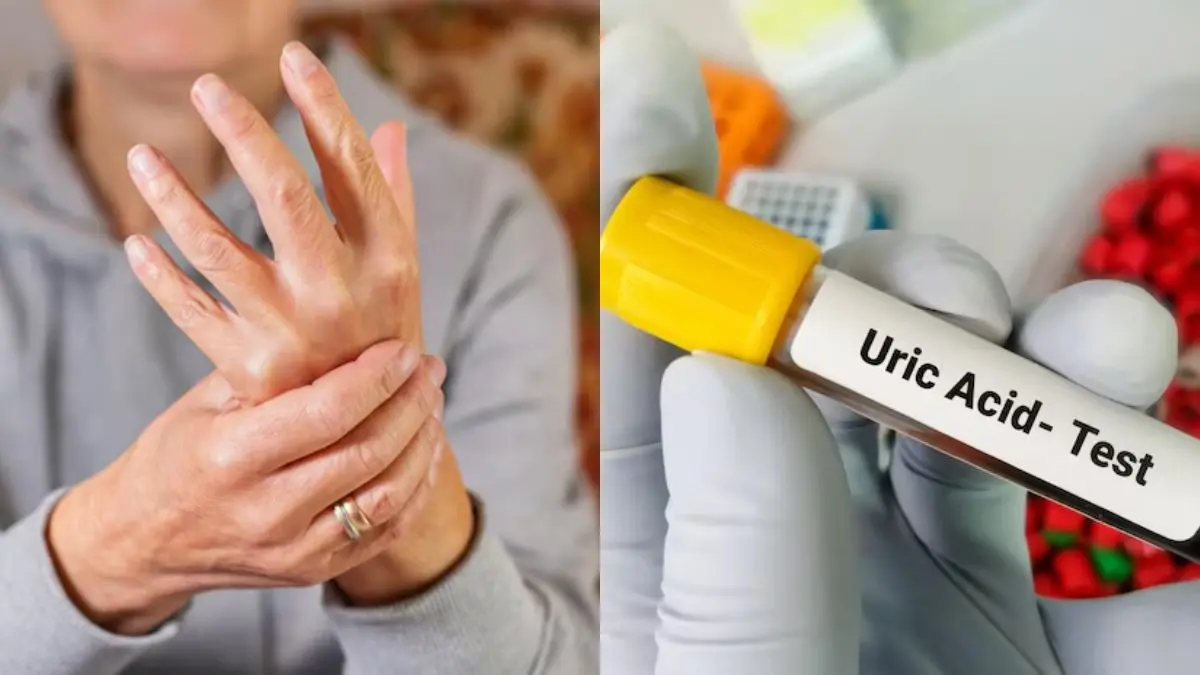 Low Uric Acid Problems: सिर्फ बढ़ना ही नहीं, यूरिक एसिड का घटना भी है खतरनाक; इन 5 लक्षणों को न करें इग्नोर Low Uric Acid Problems