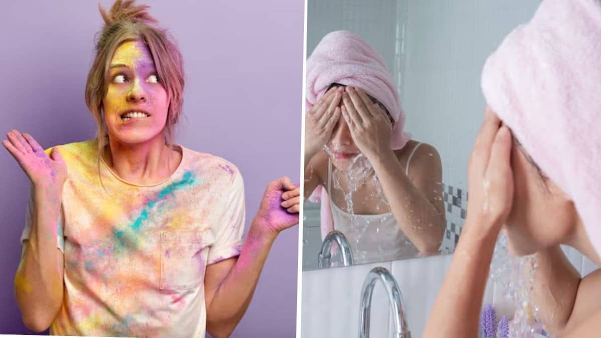 Post Holi skincare tips