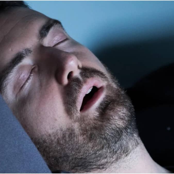 Snoring is caused by restricted airflow in the nose, mouth or throat
