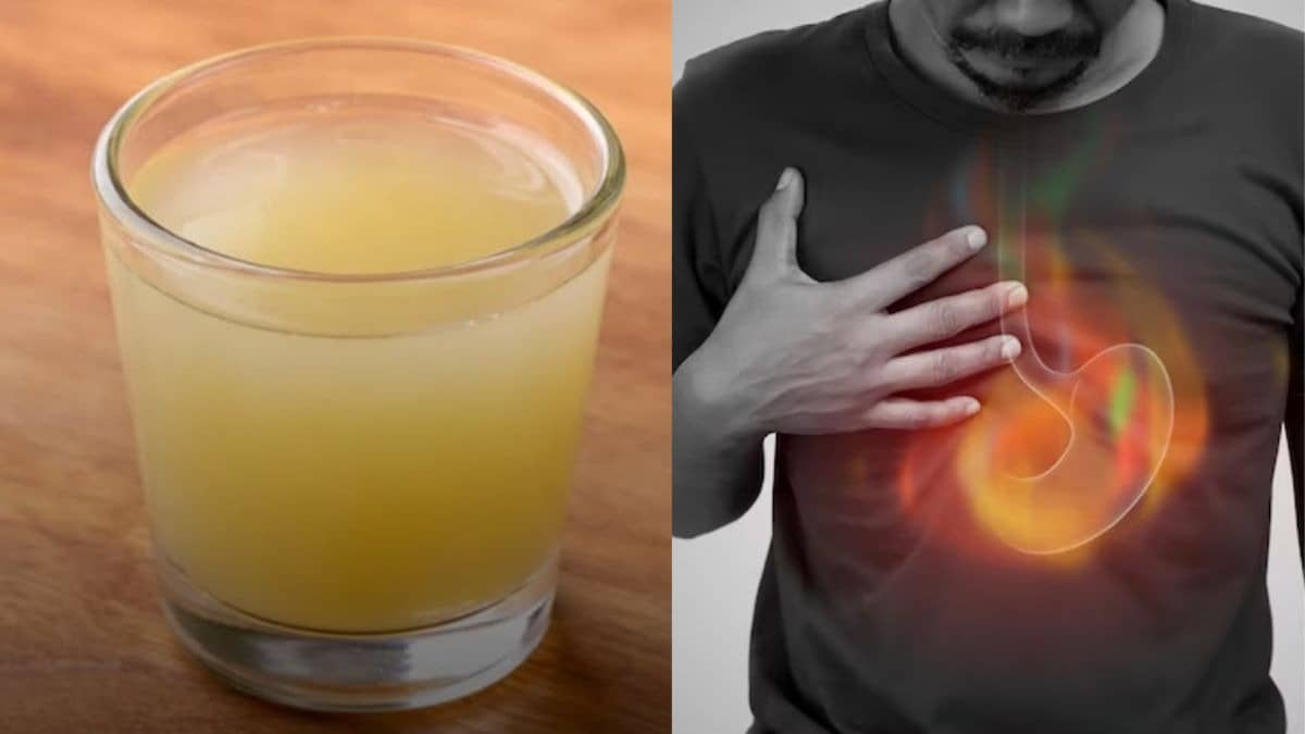  Stomach Gas Remedies