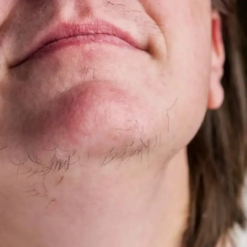 Description of the pic