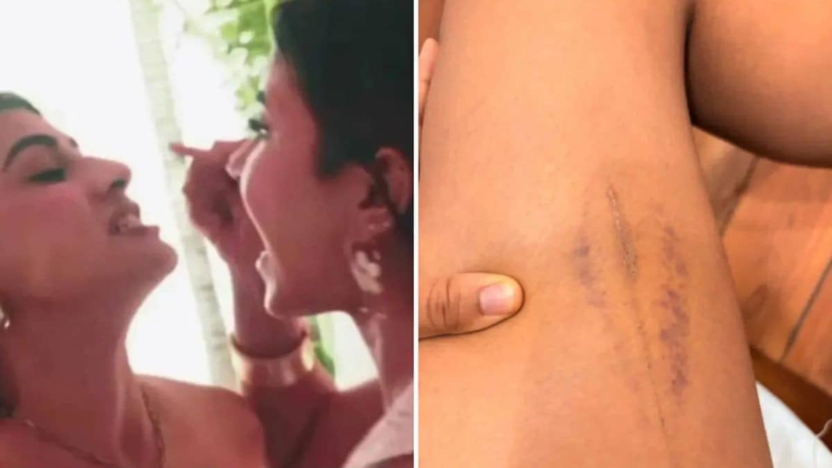 'सैंडल की हील्स से पिटाई, फाड़ दिए होंठ, खून से लथपथ जख्म...' दीक्षा ने हील मार-मारकर आकांक्षा को किया अधमरा, सनी लियोनी का फूटा गुस्सा