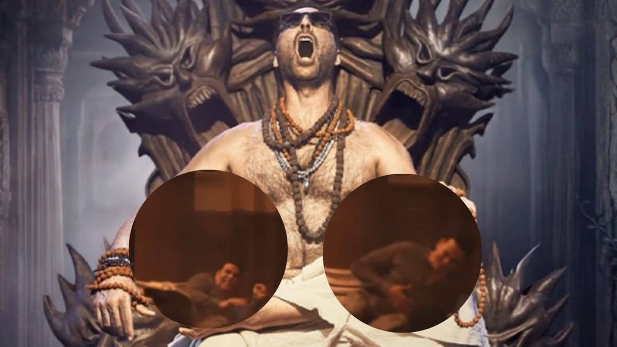 Akshay Kumar Suffers Injury 