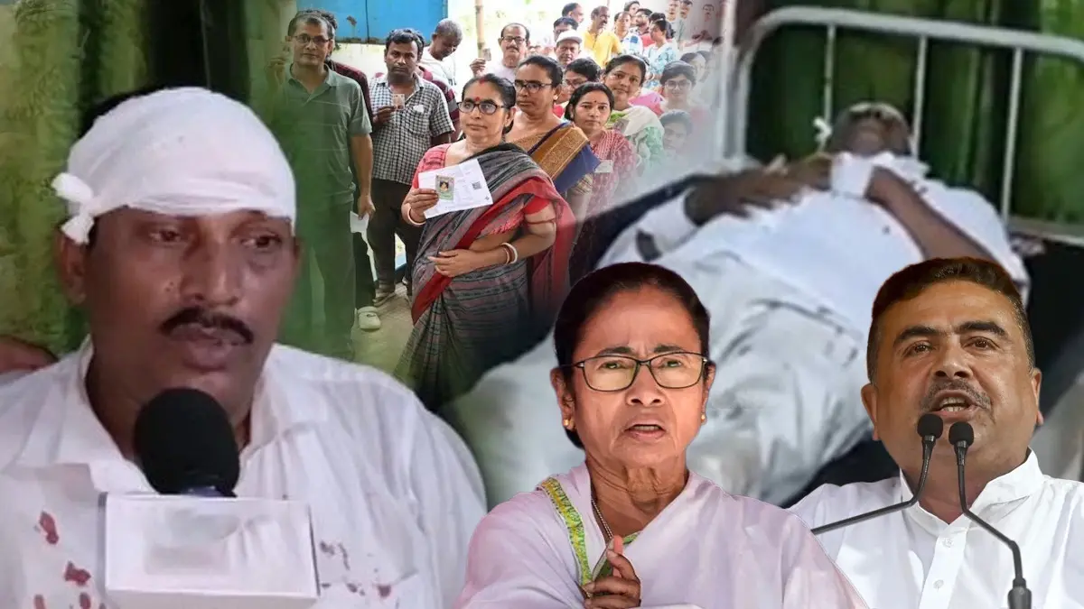 Bengal Election: '15-20 गुंडे आए, लोहे की रॉड और लाठियों से मुझे मारा', नादिया में BJP एजेंट पर हमला, TMC कार्यकर्ताओं ने फोड़ा सिर BJP polling agent Mosharraf Mir Attacked