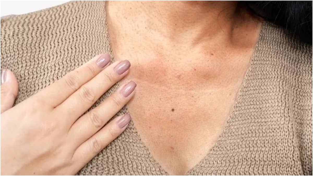 Darkness in the neck is due to dead skin cells and dirt accumulation overtime