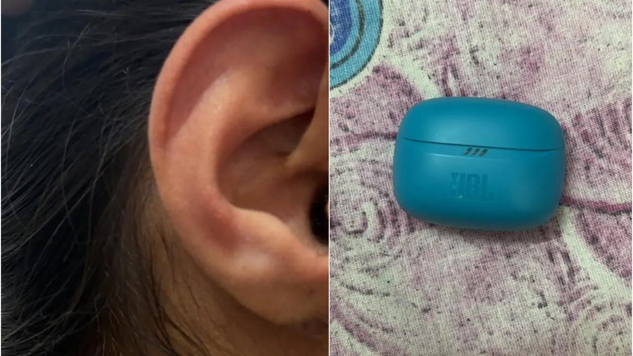 'Earphone Burst In My Ear': Girl's Viral Post Triggers Concern, JBL Responds 'Earphone Burst In My Ear': Girl's Viral Post Triggers Concern, JBL Responds