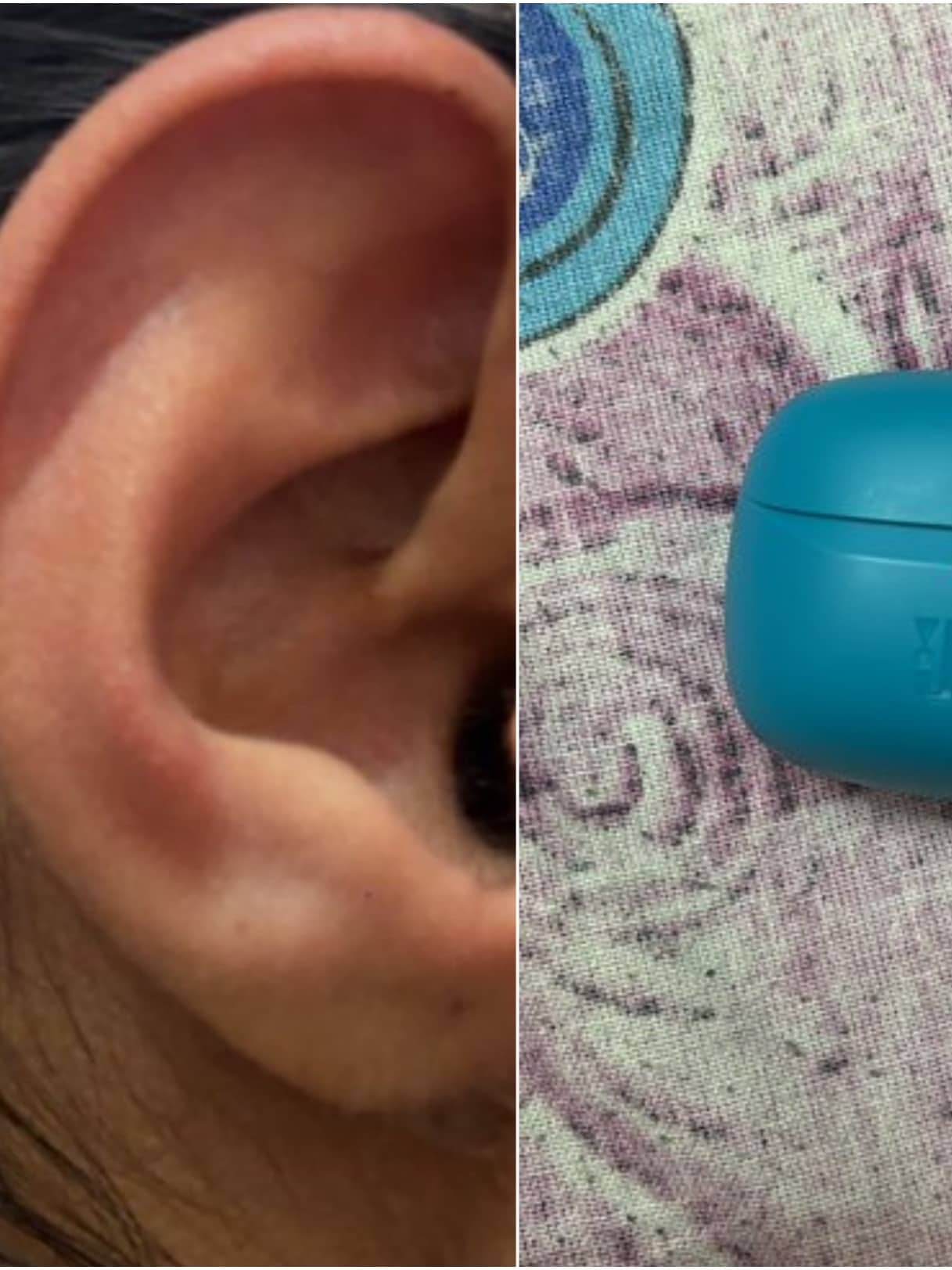 'Earphone Burst In My Ear': Girl's Viral Post Triggers Concern, JBL Responds
