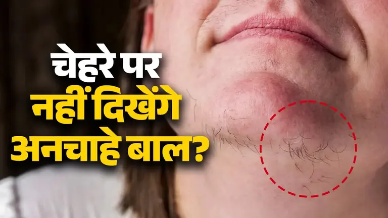 Facial Hair Removal: चेहरे से अनचाहे बालों को हटाने के लिए काम आएंगे ये 3 देसी नुस्खे, 10 मिनट में फेस लगेगा साफ facial hair removal tips at home using kitchen ingredients desi upay for clean and glowing skin