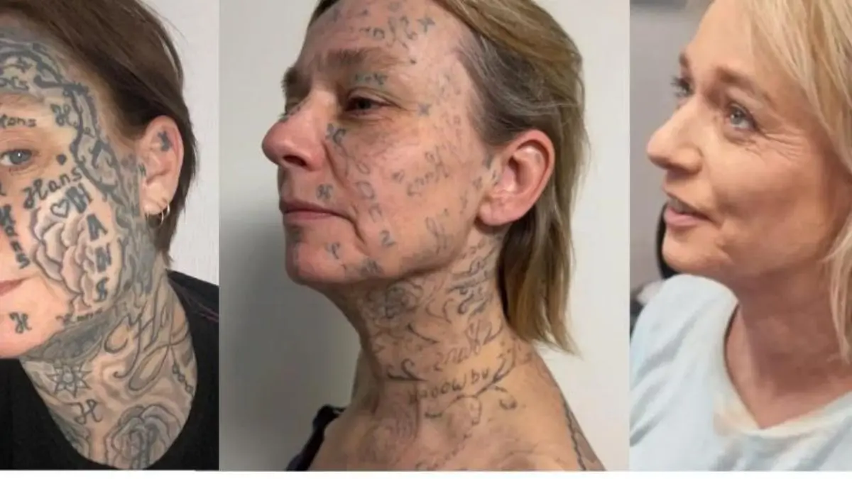 ‘His Property?’ Dutch Woman 'Forced' To Get Ex-Partner's Name Tattooed 250 Times On Her Body; Fundraiser Launched For Removal ‘Marked for Life?’ Dutch Woman Reveals Ex-Partner Tattooed His Name 250 Times On Her Body; Fundraiser Launched For Removal