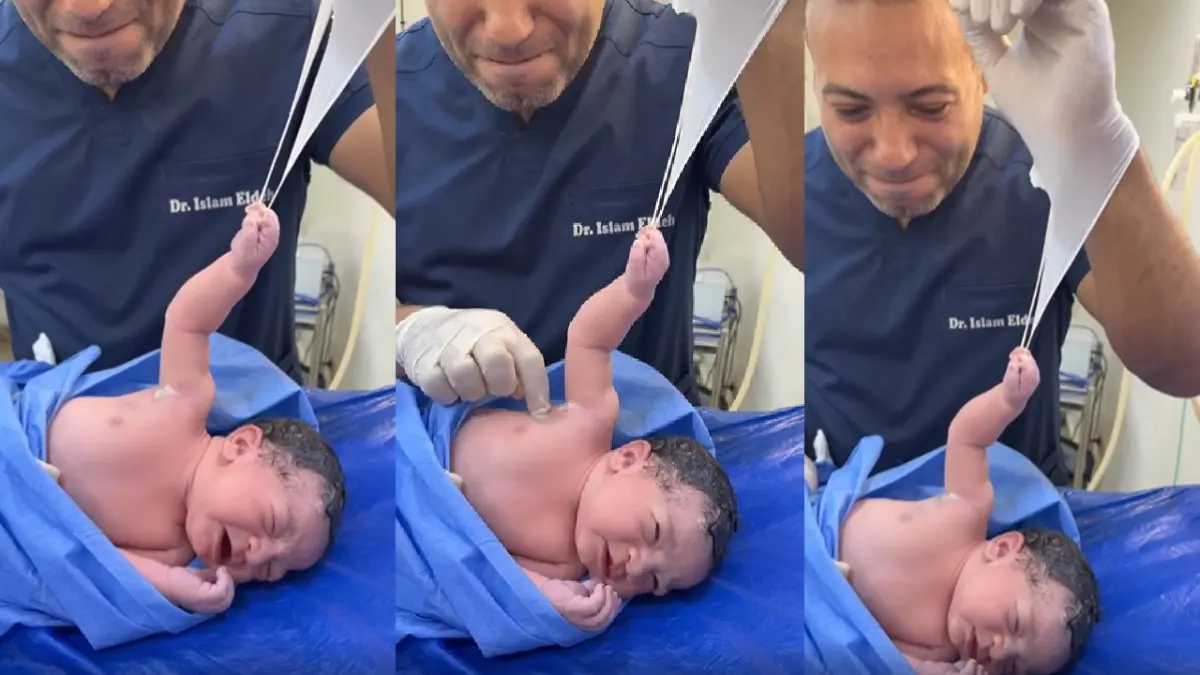 डॉक्टर का ग्लब ही छोड़ने को तैयार नहीं नवजात शिशु, पूरी जान लगाकर पकड़े रहा, बेबी की ताकत देख इंटरनेट हैरान, देखें क्यूट VIDEO Newborn Baby Holds Doctor's Glove In Viral Video