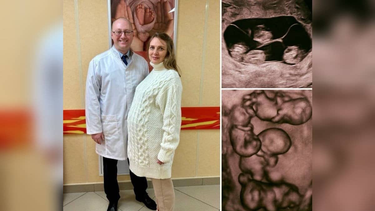 One In 15.5 Million Chance: Woman Gives Birth To 4 Identical Girls In Extremely Rare Occurrence In Russia