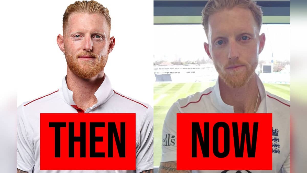 Pics Of Ben Stokes After Facial Surgery Go Viral, Spark Concern