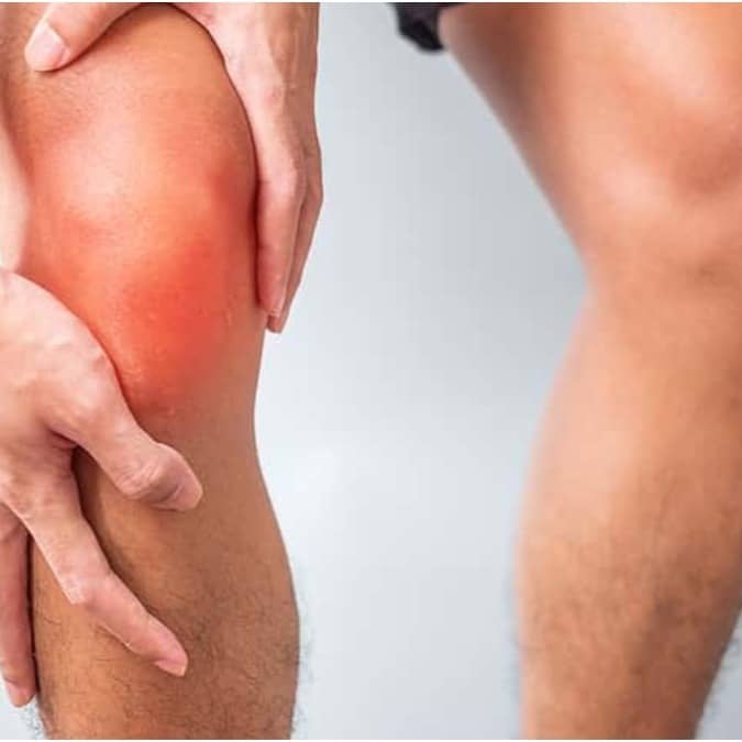 Sound of cracking knees without accompanying pain is not a cause of concern