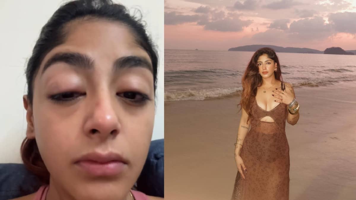 सूजी आंखें, टूटा दांत… Splitsvilla X6 फेम प्रीत सिंह पर इंफ्लुएंसर ने मुंबई क्लब में किया हमला, उर्फी जावेद बोलीं- पुलिस के पास जाओ