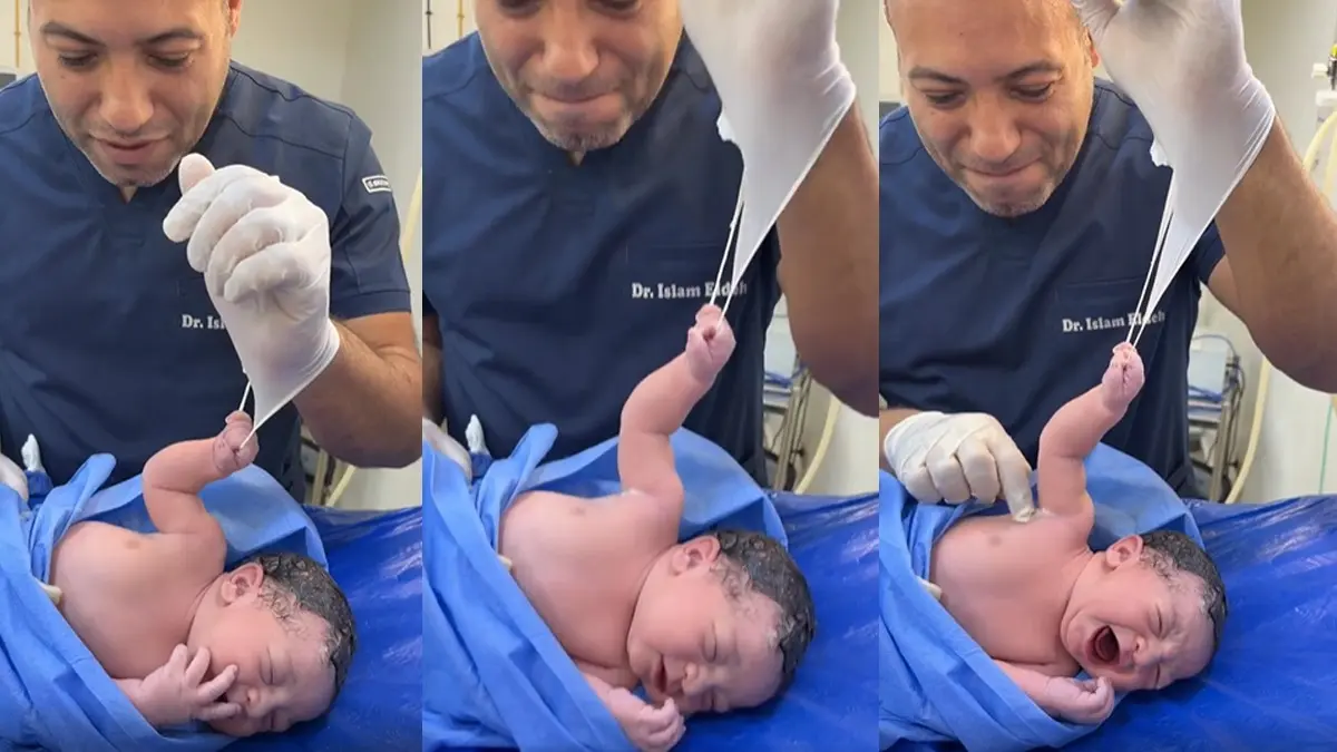 ‘Wait, Don’t Leave Yet!’: Newborn Baby Grabs Doctor’s Glove In A Viral Video, Internet Melts | WATCH ‘Wait, Don’t Leave Yet!’: Newborn Baby Grabs Doctor’s Glove In A Viral Video, Internet Melts | WATCH