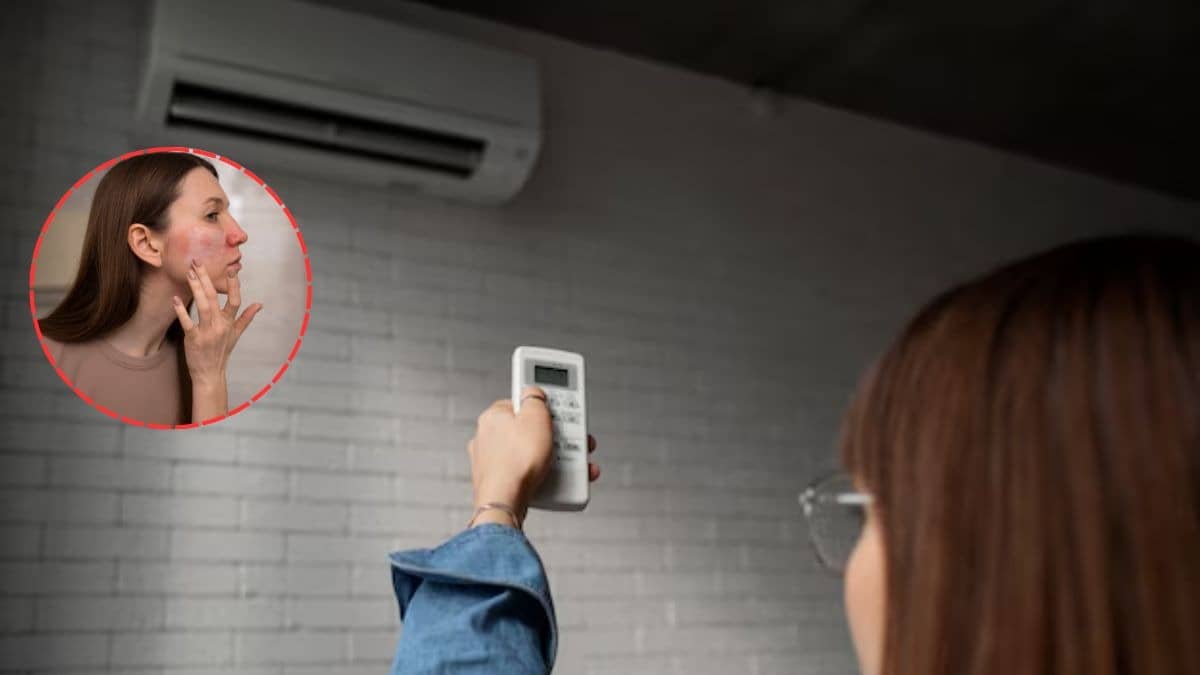How to fix Skin dryness due to AC