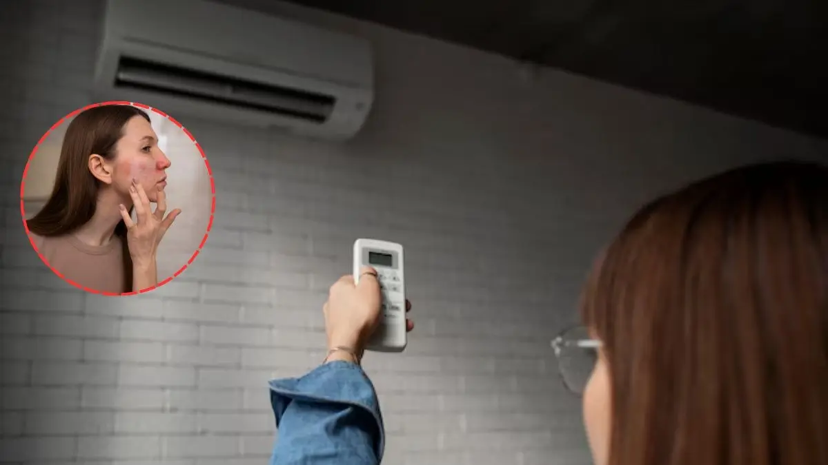 Constant AC Use Can Be The Biggest Skincare Villain, Here's How You Can Prevent Youself From Dryness In Summer How to fix Skin dryness due to AC