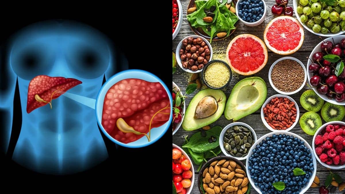 Liver Swelling: लिवर की सूजन से हैं परेशान? डाइट में शामिल करें ये 6 सुपरफूड्स