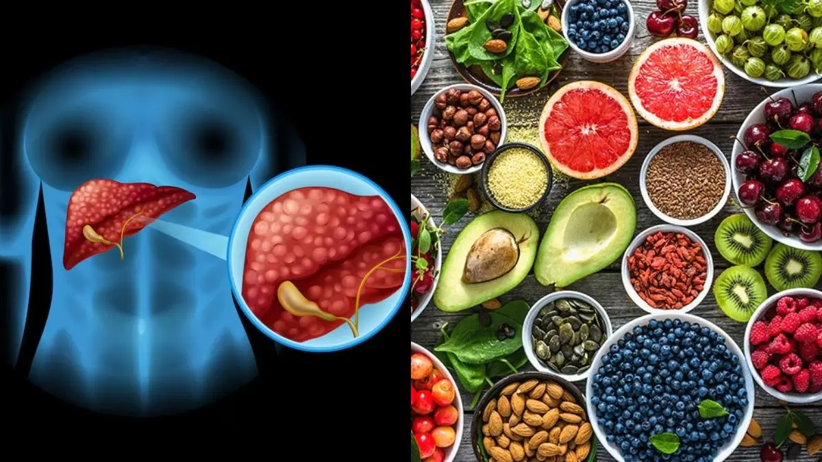 Liver Swelling: लिवर की सूजन से हैं परेशान? डाइट में शामिल करें ये 6 सुपरफूड्स 6 foods to get rid of liver swelling know how to intake benefits and health tips