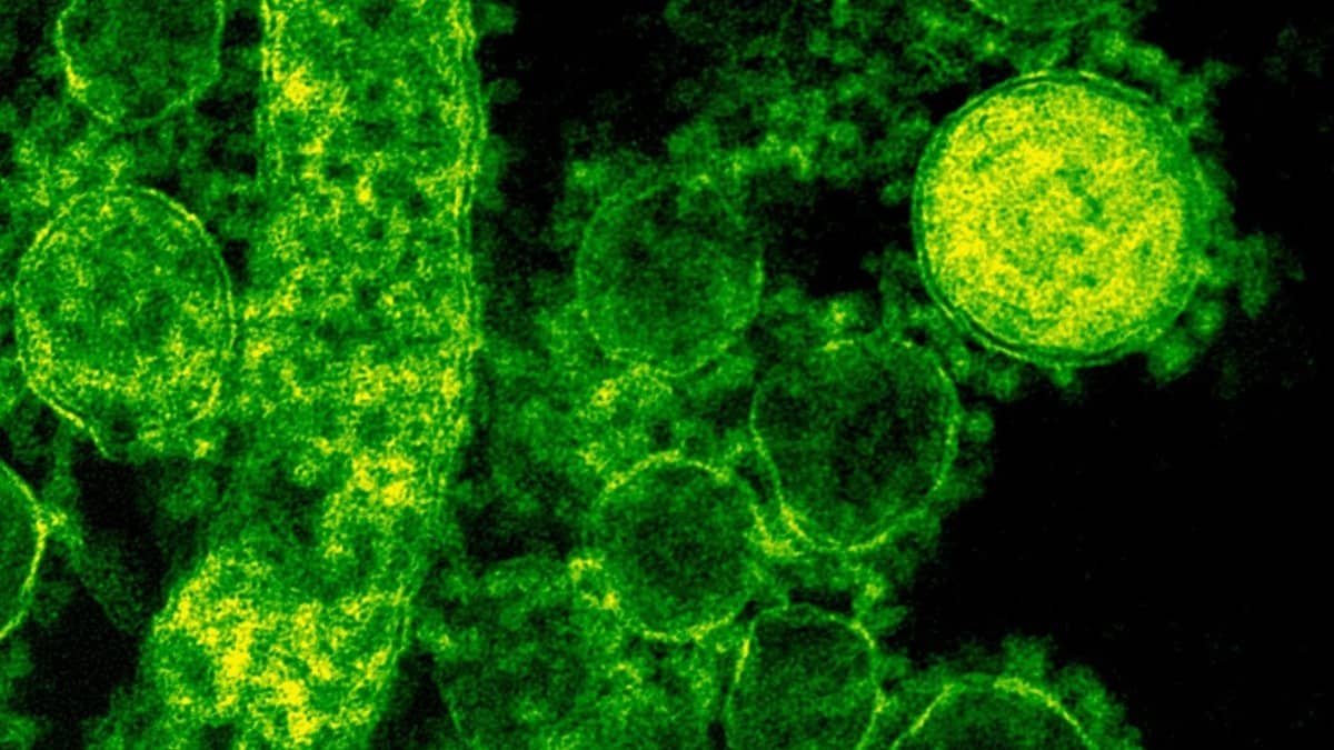 Shigella Cases on the rise in Kerala