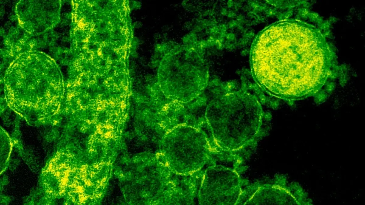 Kerala Health Alert: 70 Shigella Cases and 5 Deaths in a Month, Kozhikode and Mallapuram Emerge as Worst Hit Districts Shigella Cases on the rise in Kerala
