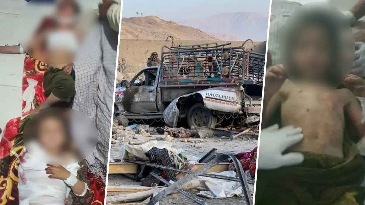 'Act Of Brutality': Kabul Tears Into Pakistan Over Cross-Border Strikes, Releases Haunting Images Of Injured Children X