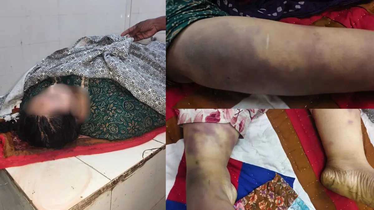 हैवानियत की इंतहा! बेल्ट से बेरहमी से पीटकर पत्नी की हत्या, अंतिम संस्कार से ठीक पहले खुला पति का खौफनाक राज Kutch Murder