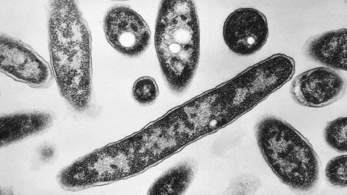 Legionnaires' disease outbreak in NYC