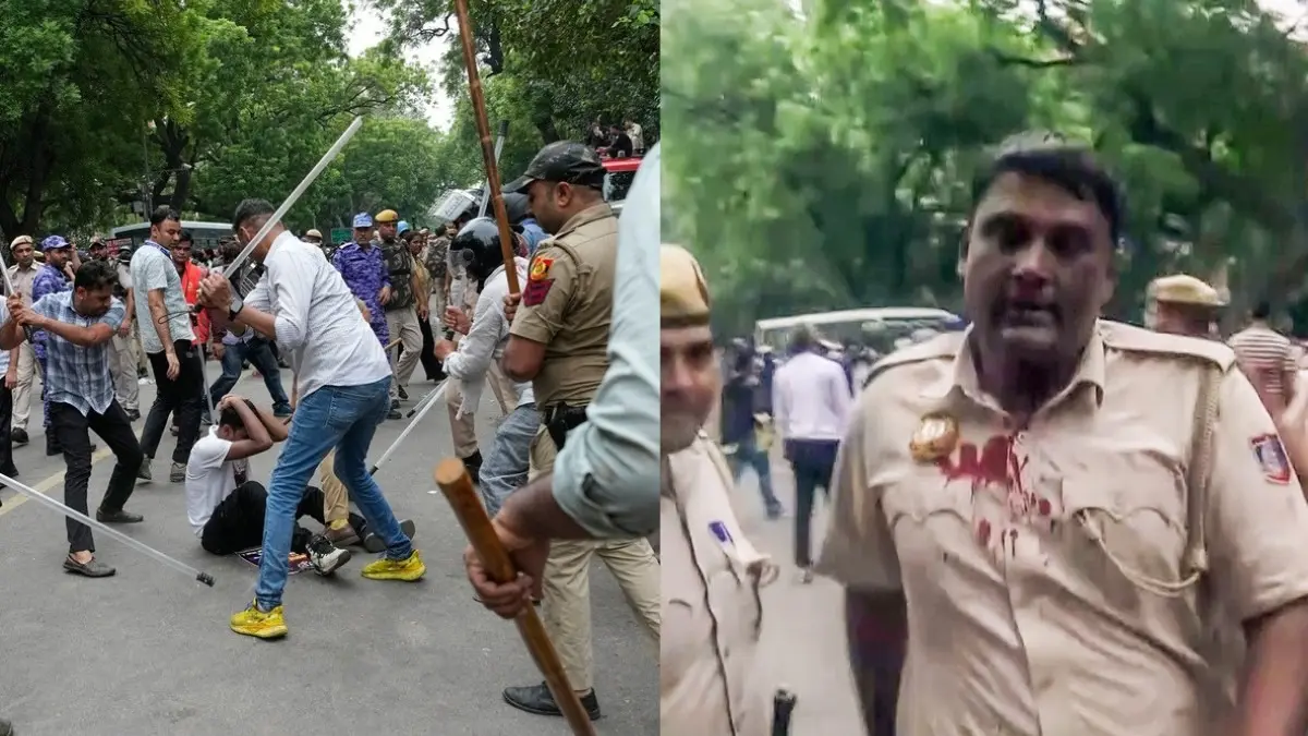 Stone-Pelting & Scuffles: Cops Bleed As CJP Protest Turns Violent, Say Those Deployed Near Security Barricades Targeted Stone-Pelting & Scuffles: Cops Bleed As CJP Protest Turns Violent, Say Those Deployed Near Security Barricades Targeted
