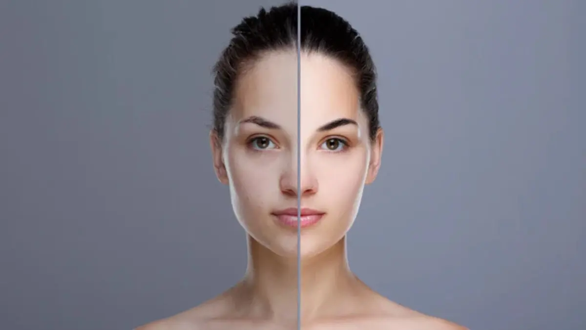 Home Remedies For Uneven Skin Tone And How To Use Them Tanning, pollution and dryness among other reasons cause uneven skin tone
