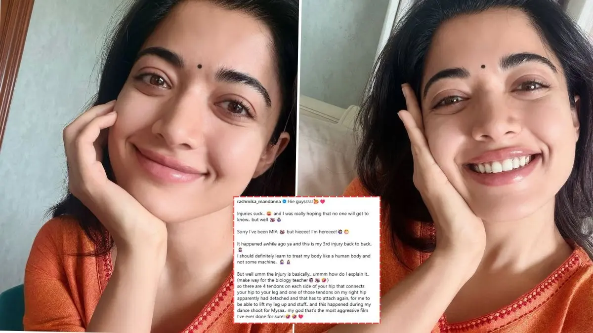 Rashmika Mandanna Confirms Injury On Mysaa Set, Calls It The 'Most Aggressive Film' Rashmika Mandanna confirms injuries