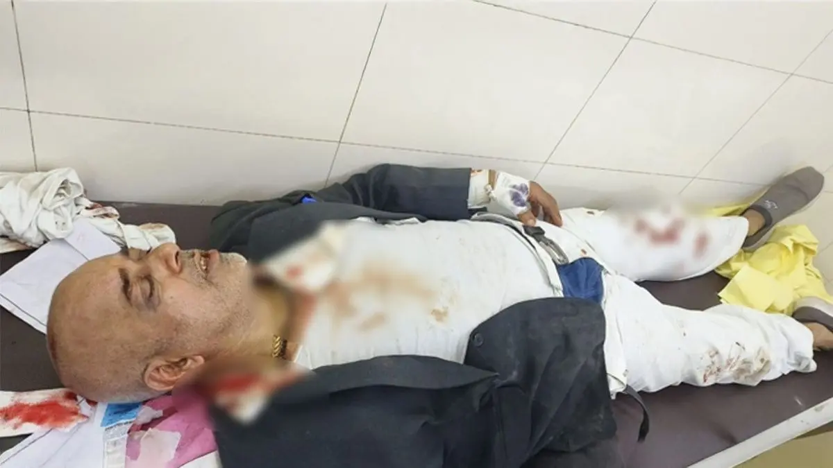 UP: प्रयागराज से बड़ी खबर, अधिवक्ता सतीश चंद्र की सरेआम गोली मारकर हत्या, घटना को लेकर वकीलों में आक्रोश Advocate Satish Chandra shot dead