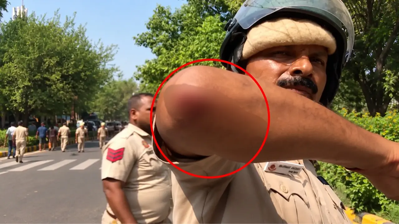 Cop Injured After Stone Pelting During CJP Protest Against CEC in Delhi Cop Injured After Stone Pelting During CJP Protest Against CEC in Delhi