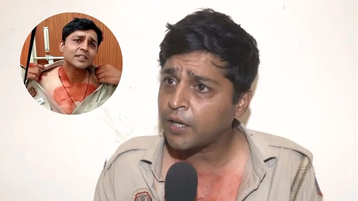 ‘They Tore My Uniform, Bit Me’: Delhi Cop Alleges Assault By Protesters During Rahul Gandhi Detention ‘They Tore My Uniform, Bit Me’: Delhi Cop Alleges Assault By Protesters During Rahul Gandhi Detention