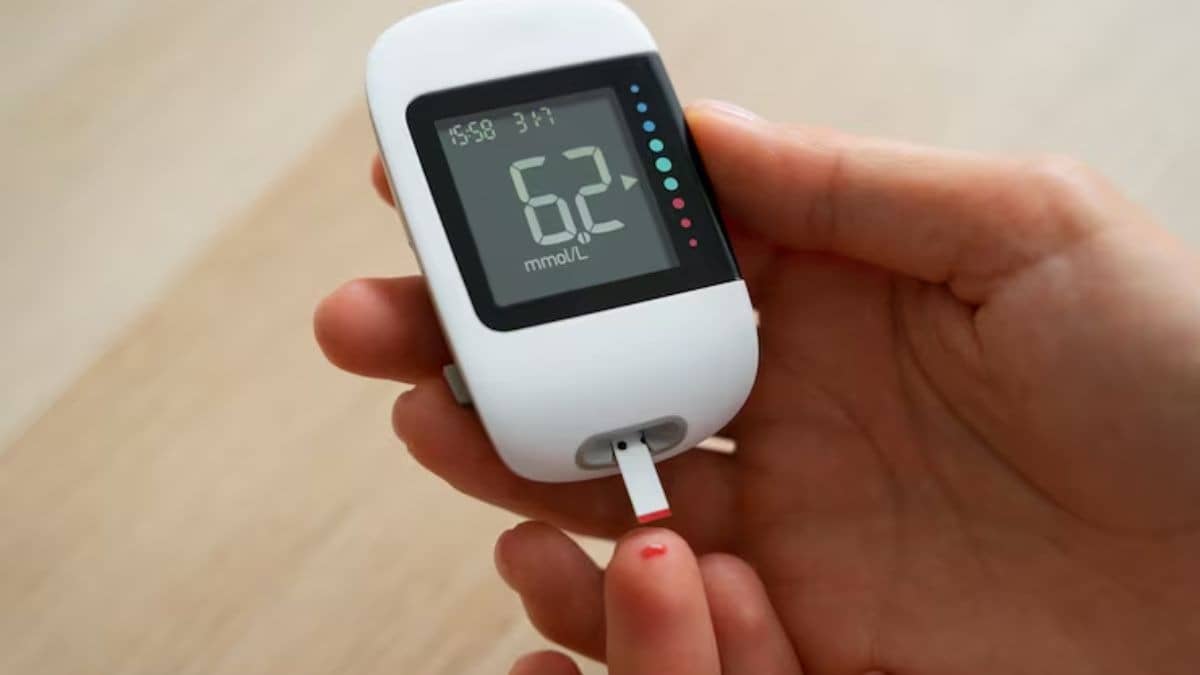 Description of the pic