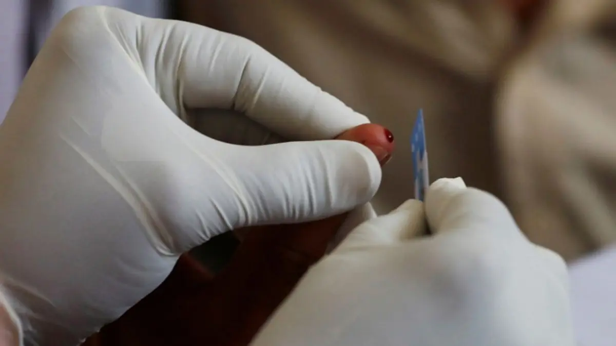 Faulty HIV Figures Raise Alarm in National Assembly Panel as Pakistan Risks Global Embarrassment A medical worker draws blood for a HIV test in Pakistan