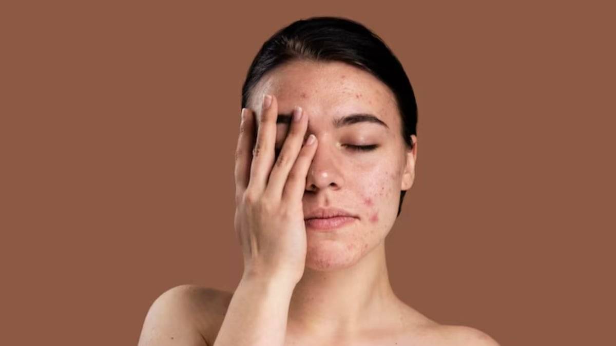 Description of the pic