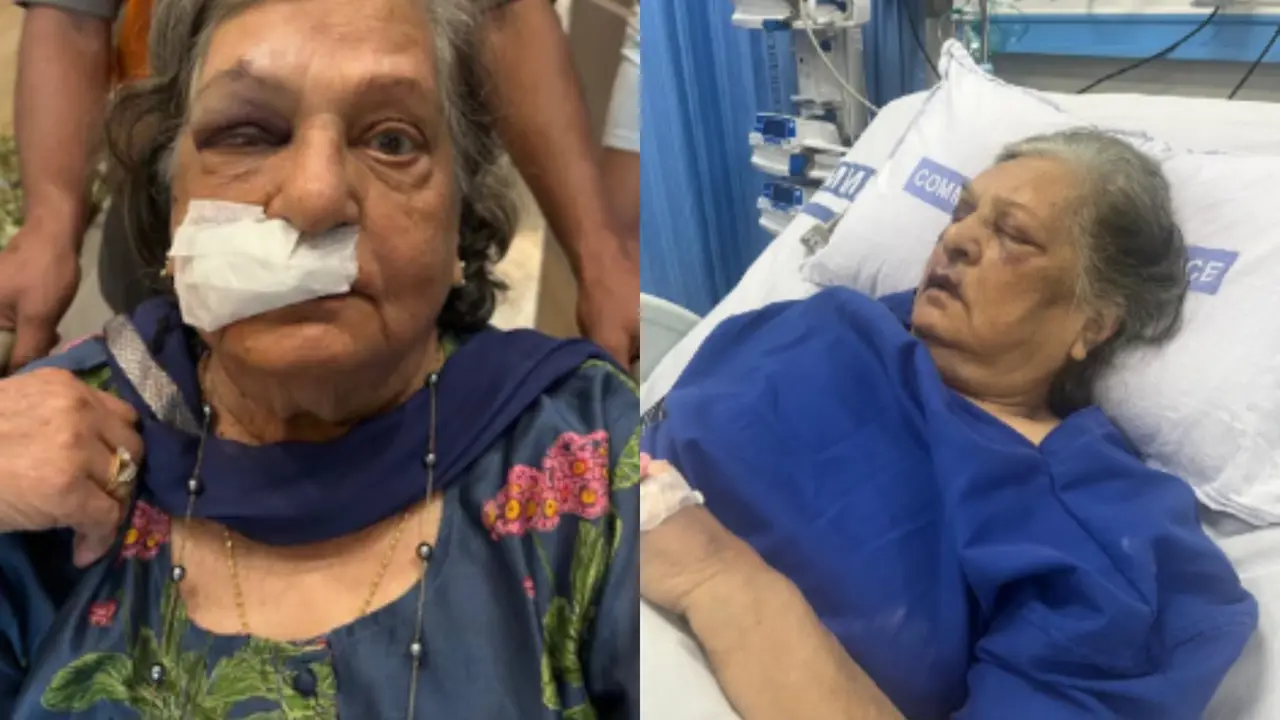 Air India Under Fire After 82-Year-Old Falls at Delhi Airport, Lands in ICU; Airline Responds Air India denied wheelchair to an elderly passenger