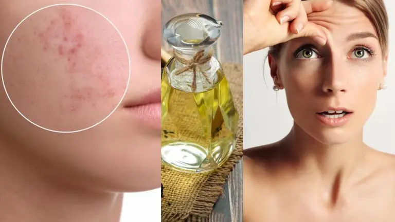 Anti Ageing Face Oil: चेहरे पर दिख रही हैं झुर्रियां और बार-बार आ रहे हैं मुंहासे? रात में लगाएं ये तेल, चेहरा हो जाएगा चमकदार Anti Ageing Face Oil